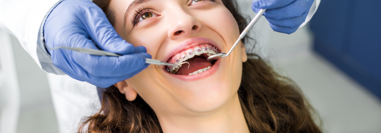 Ortodoncia ¿Es solo cuestión de estética? – Bukal
